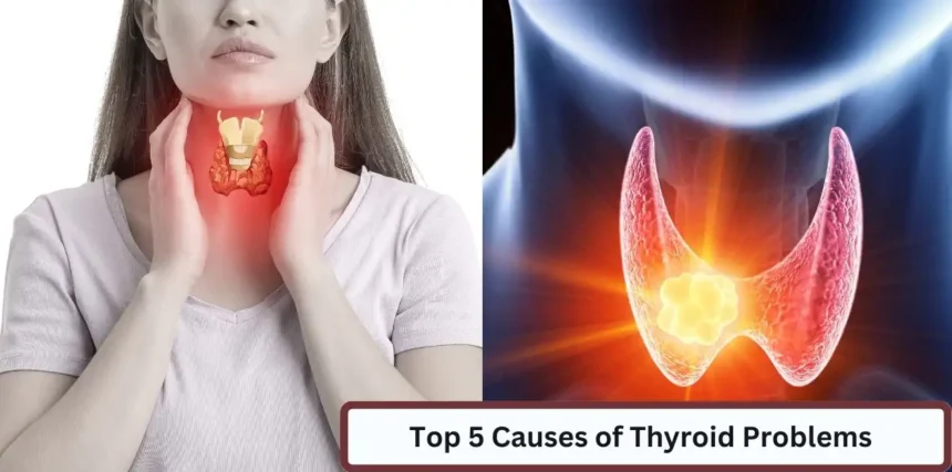 The Top 5 Causes of Thyroid Problems and How to Fix Them - Fudola