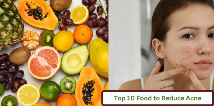 Top 10 Foods for Clear Skin Say Goodbye to Acne