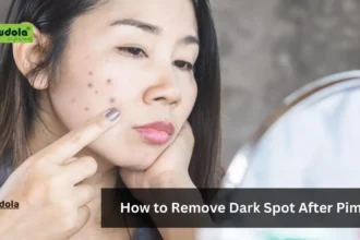 How to Remove Dark Spot