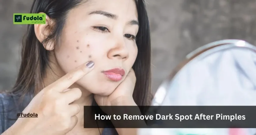 How to Remove Dark Spot