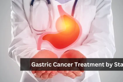 Gastric Cancer Treatment by Stage