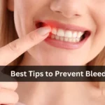 Tips to Prevent Bleeding Gums