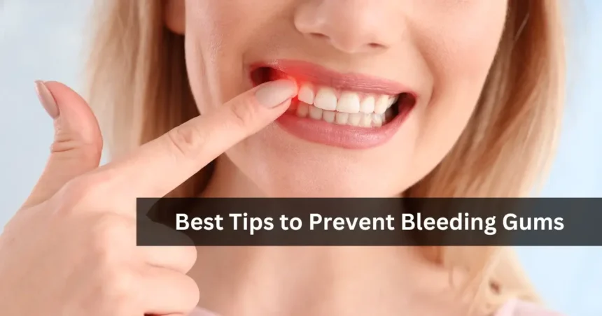 Tips to Prevent Bleeding Gums