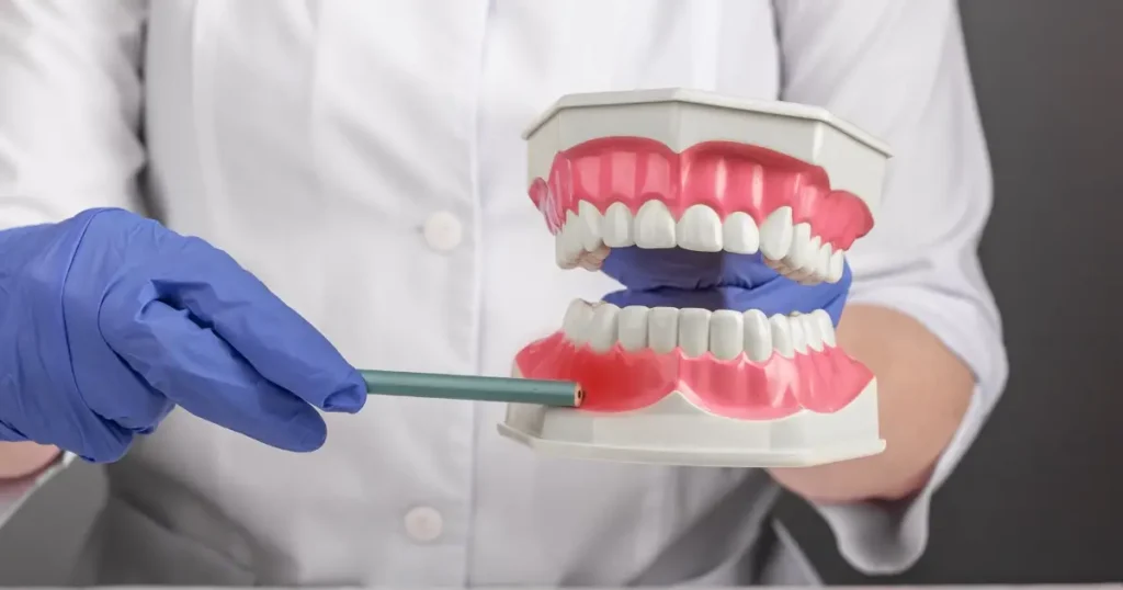 tips for the prevention of bleeding gums